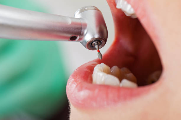 Best Emergency Dental Care for Abscessed Tooth in Kiryas Joel, NY